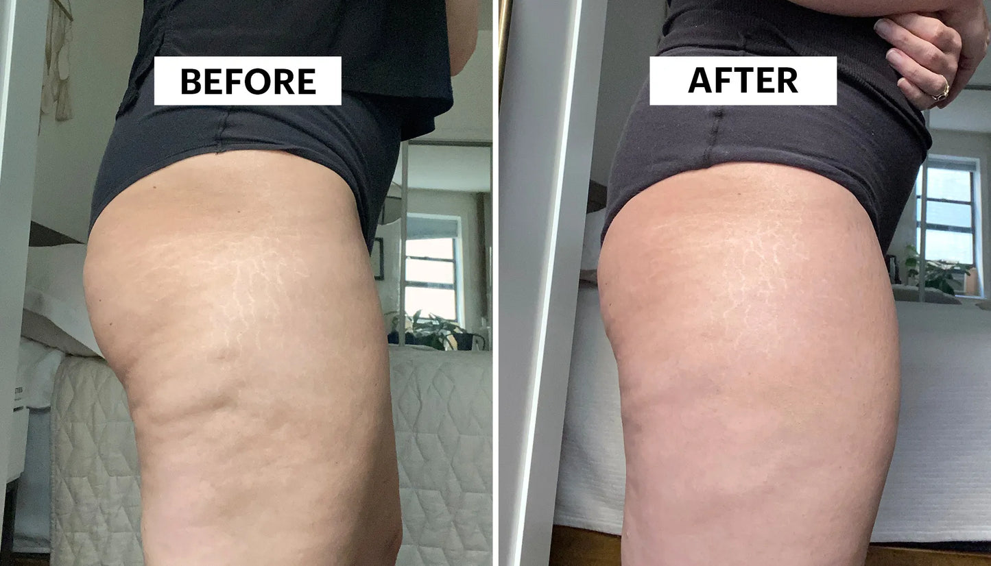 Gold-Infused Cryo-Thermo Firming Gel