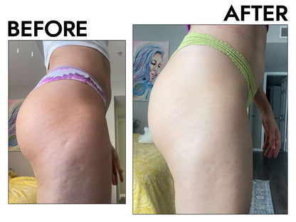 Gold-Infused Cryo-Thermo Firming Gel